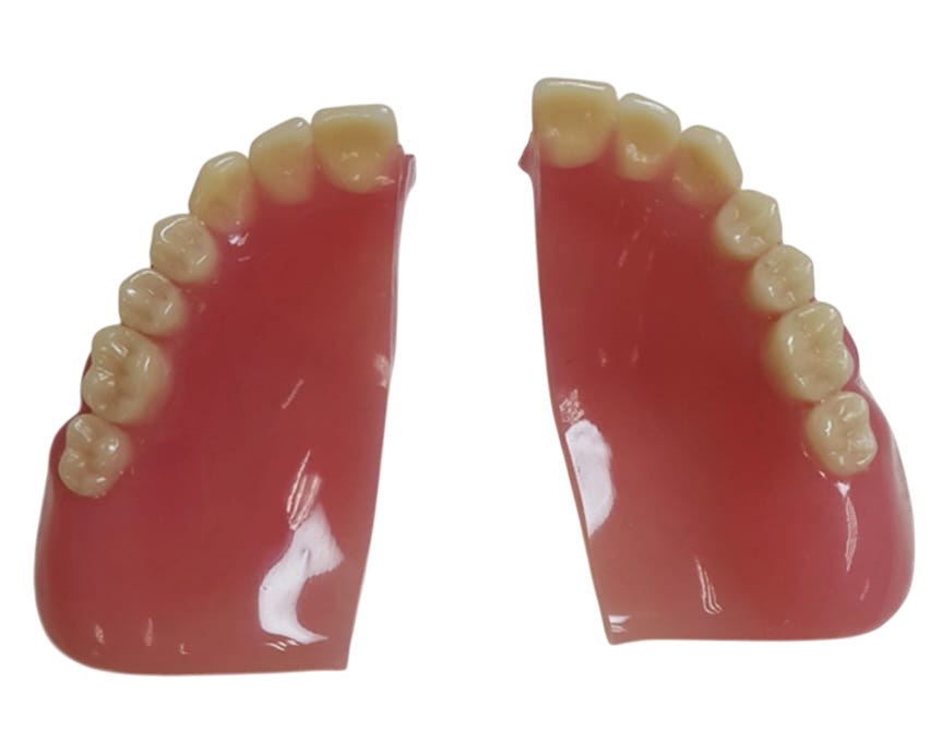 Proteză acrilică finisată manual — exemplu de lucrare din laboratorul dentar din Focșani